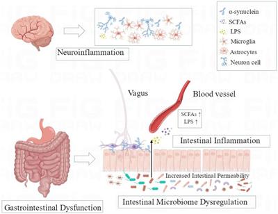 The role of the microbiota-gut-brain axis and intestinal microbiome dysregulation in Parkinson’s disease